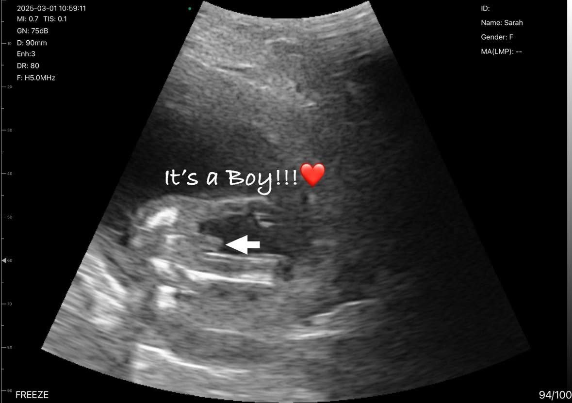 An ultrasound image showing a baby with the caption It's a Boy.